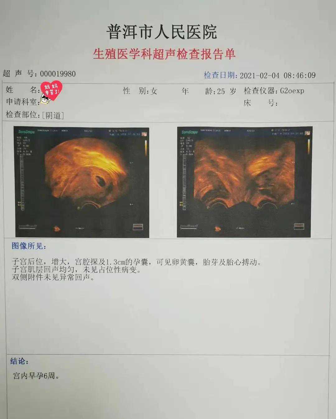 北京做代孕那家医院好|是爱 是暖 是希望-滇西南首例第二代试管婴儿在普洱市