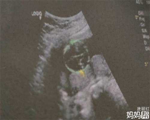 北京五洲妇儿医院能治不代孕症吗备代孕技巧有