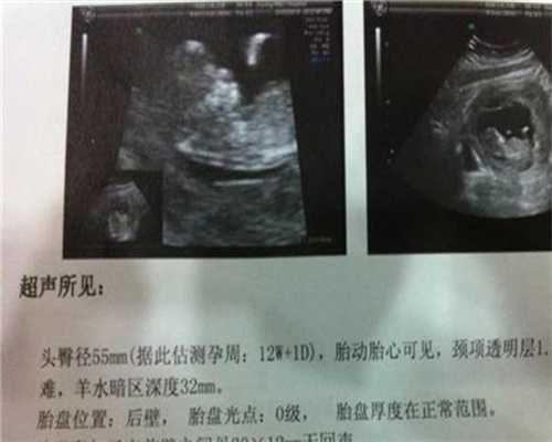 孕妇吃什么可以消滞_北京合法代孕