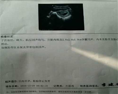 孕妇能不能吃罂粟苗_北京代孕哪里最专业