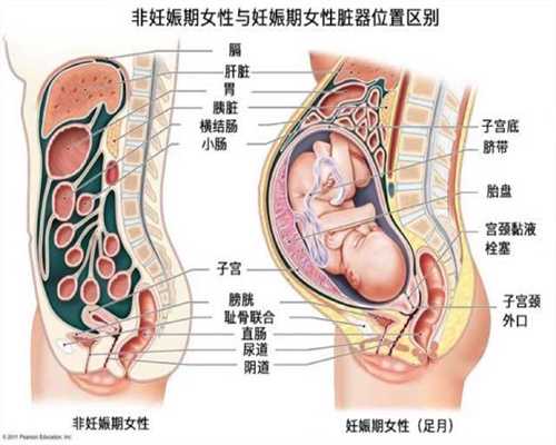 泰国代理孕母价格：怀代孕间胃痛怎么办 代孕胃
