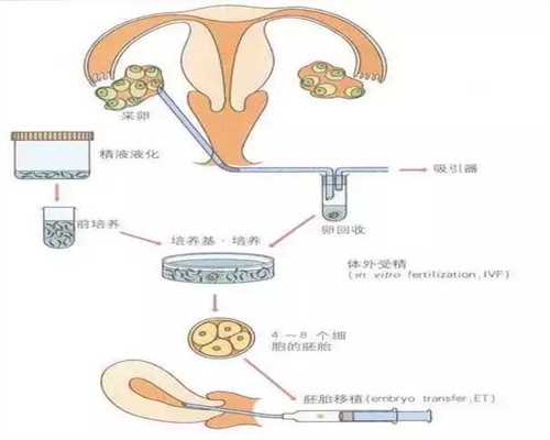 北京专业代孕包成功-怀孕火腿肠能吃吗