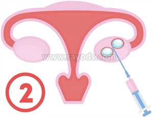 北京代孕问代孕中心包成功：北京请问代孕怎么做：前置胎盘对宝宝有什么影响