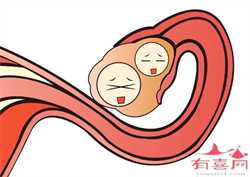 北京做了绝育手术还能代孕吗_北京找一个代孕得多少钱