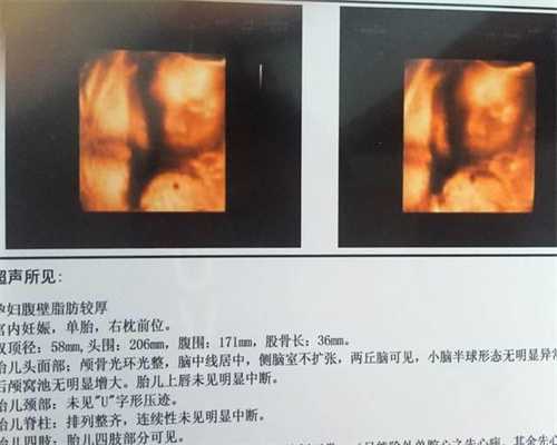 三女子导致一男子不孕不育_北京供精孩子多吗_孕妇高压135是否正常？
