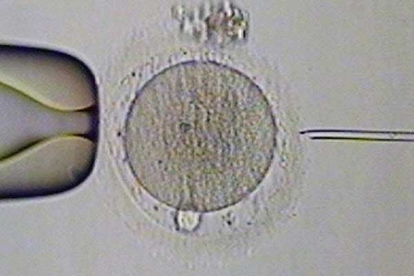 泰州37岁供卵试管几率大不大_女性不孕不育做试管婴儿会有伤害吗?