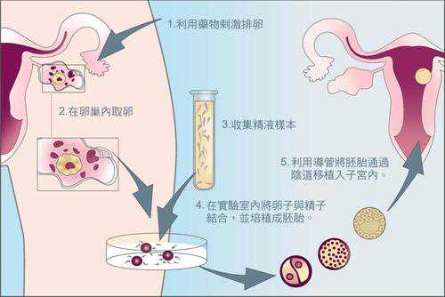 北京国内可以供卵的医院_试管婴儿IVF就诊流程过程详细攻略
