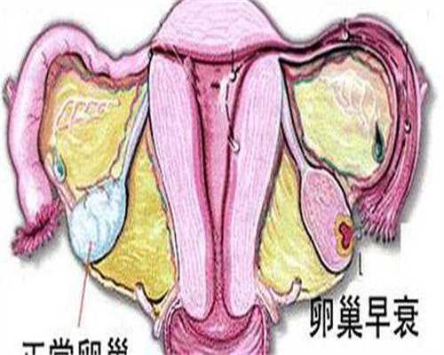 不孕不育多少钱