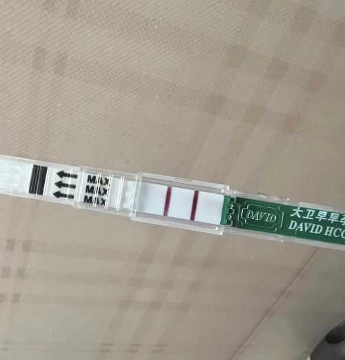 弱精症试管