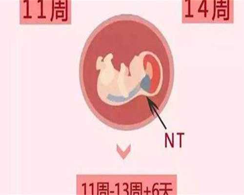 精子数量少不育