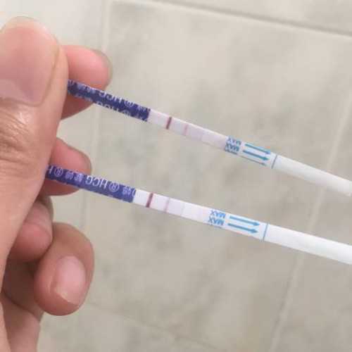 抗精子抗体不育
